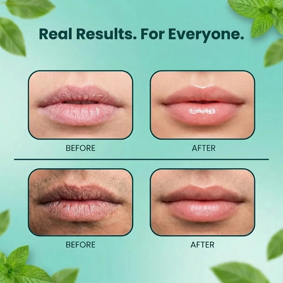 Keffios ™ - Man Lip Mask